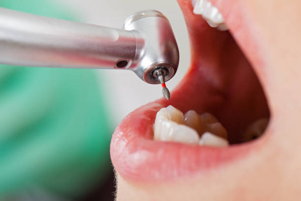 Best Dentist Open Late Near Me  in Pquemine, LA